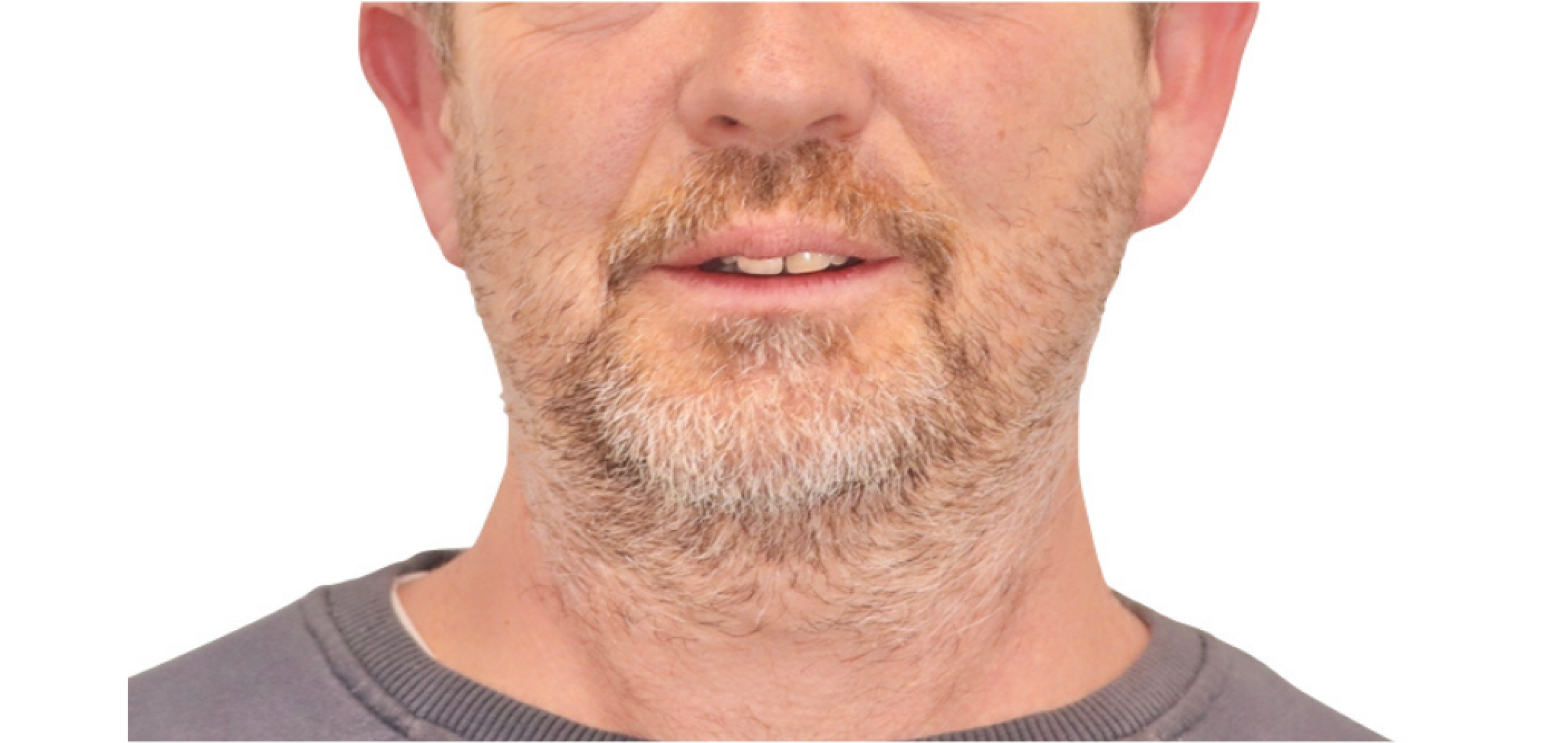 Exemples de cas traités par le Dr Quentin Boison