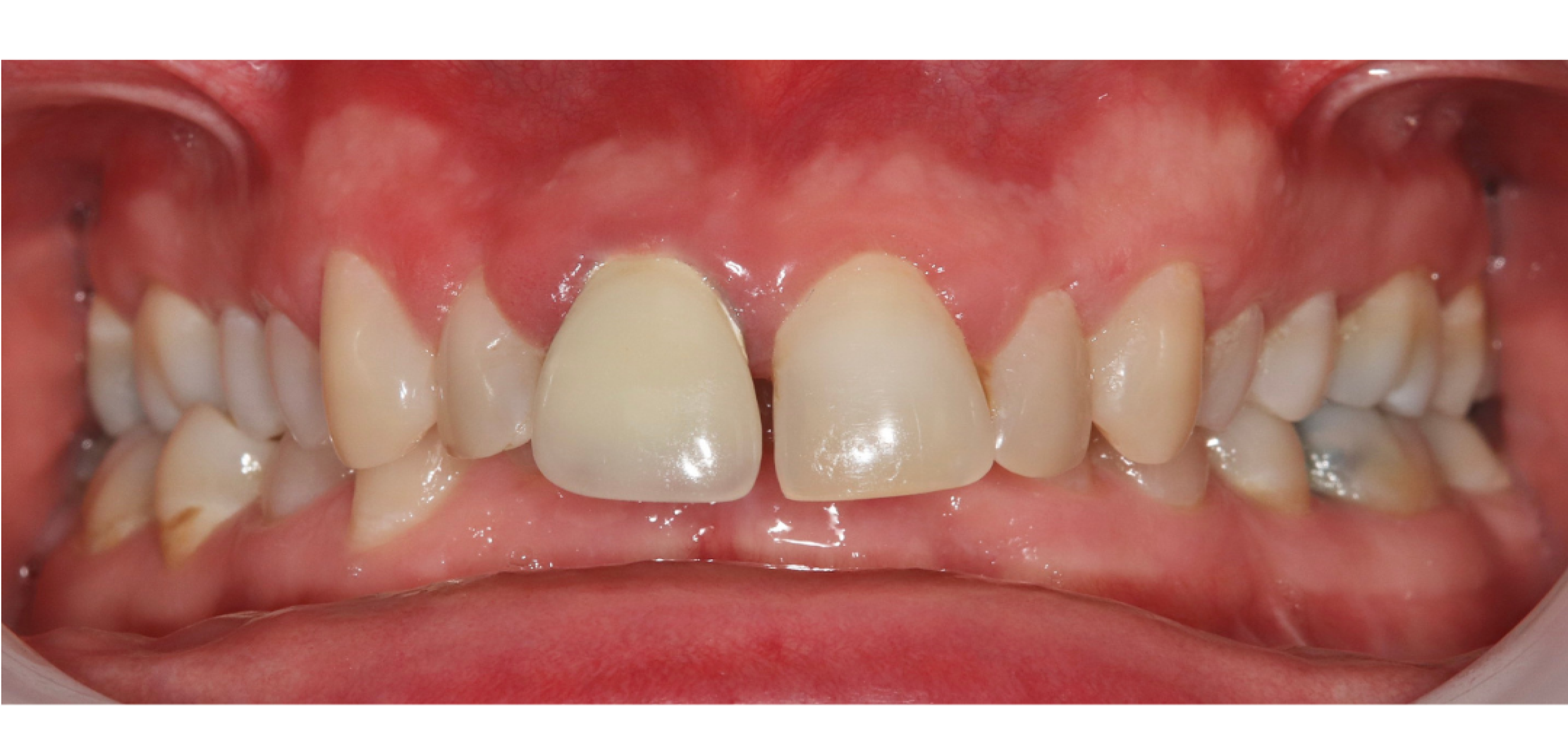 Exemples de cas traités par le Dr Quentin Boison