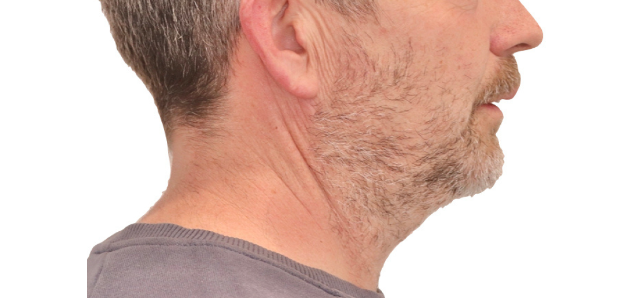 Exemples de cas traités par le Dr Quentin Boison