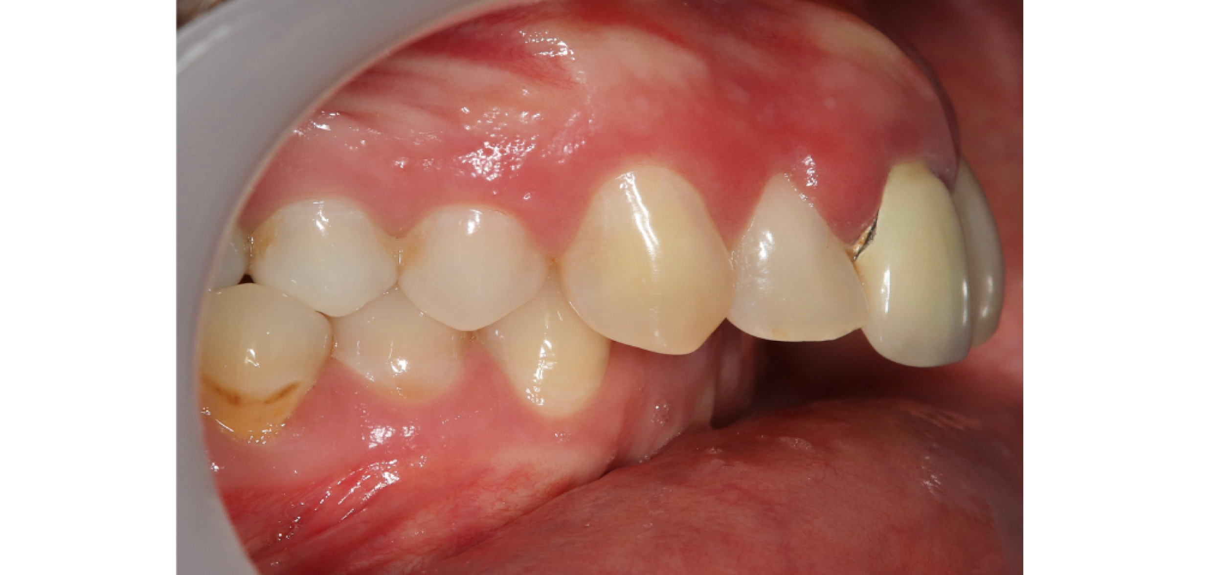 Exemples de cas traités par le Dr Quentin Boison