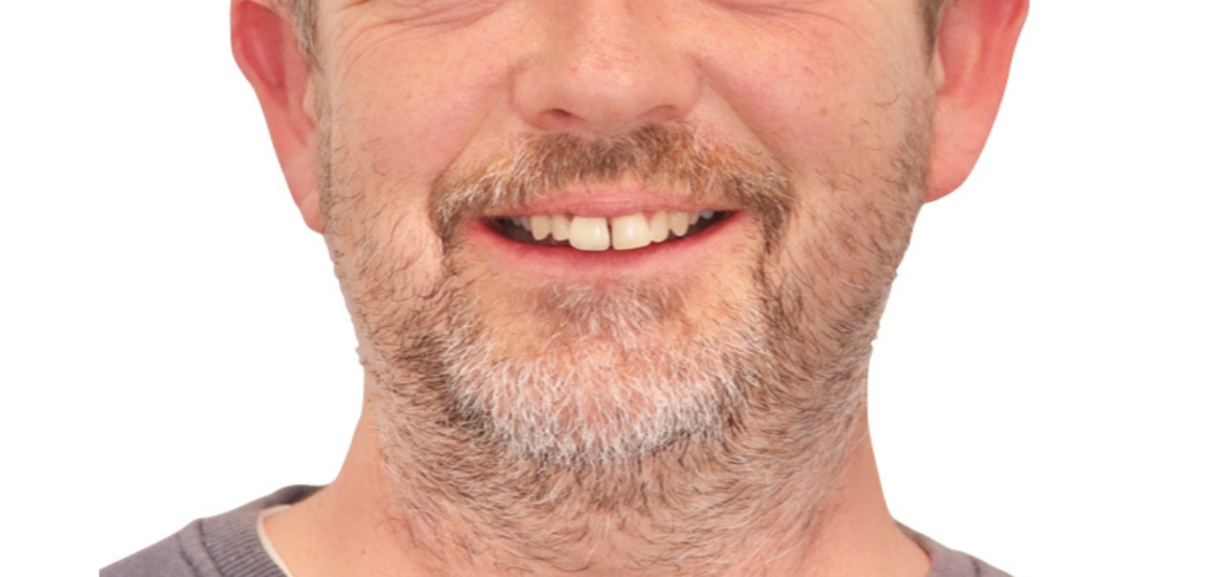 Exemples de cas traités par le Dr Quentin Boison