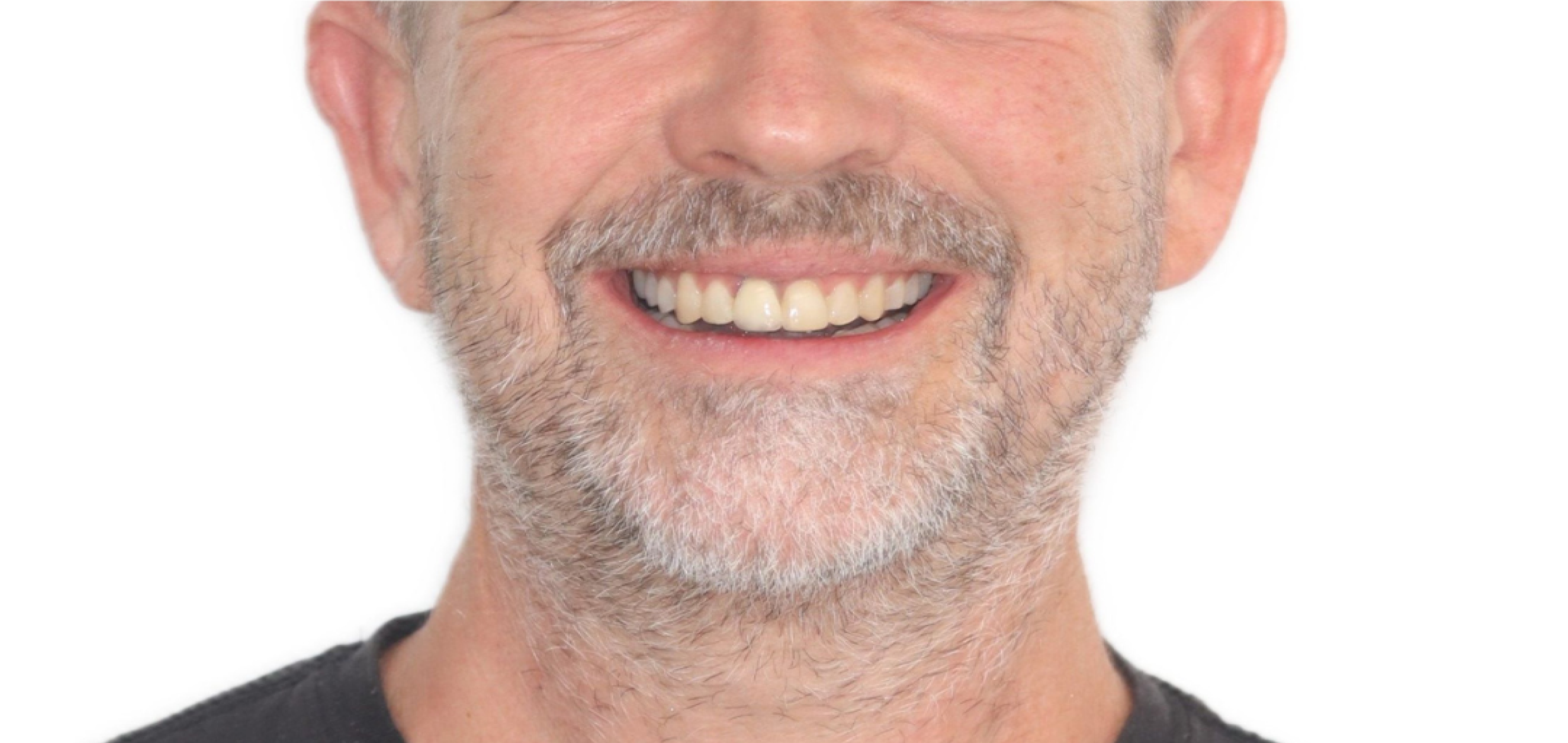 Exemples de cas traités par le Dr Quentin Boison