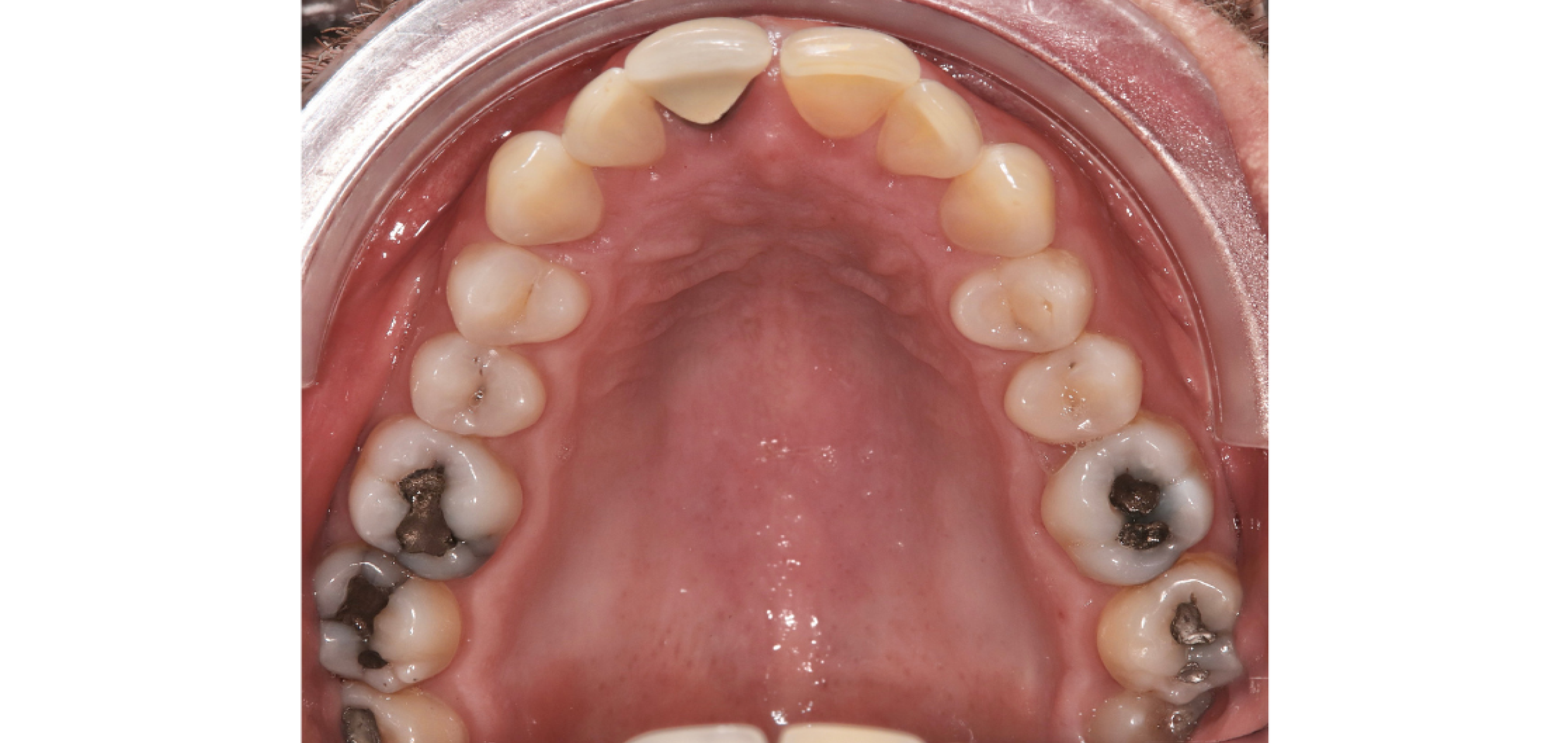 Exemples de cas traités par le Dr Quentin Boison