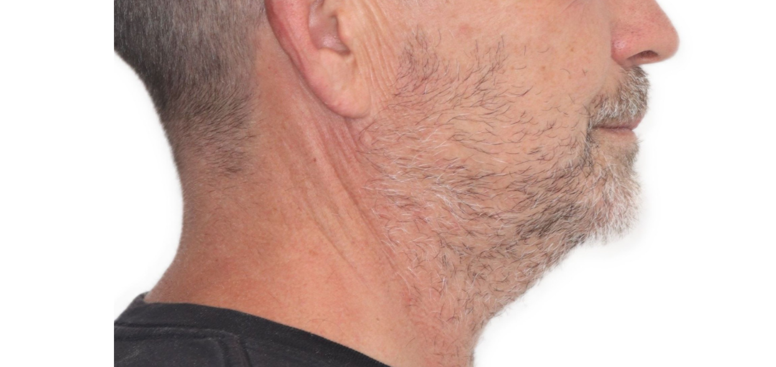 Exemples de cas traités par le Dr Quentin Boison