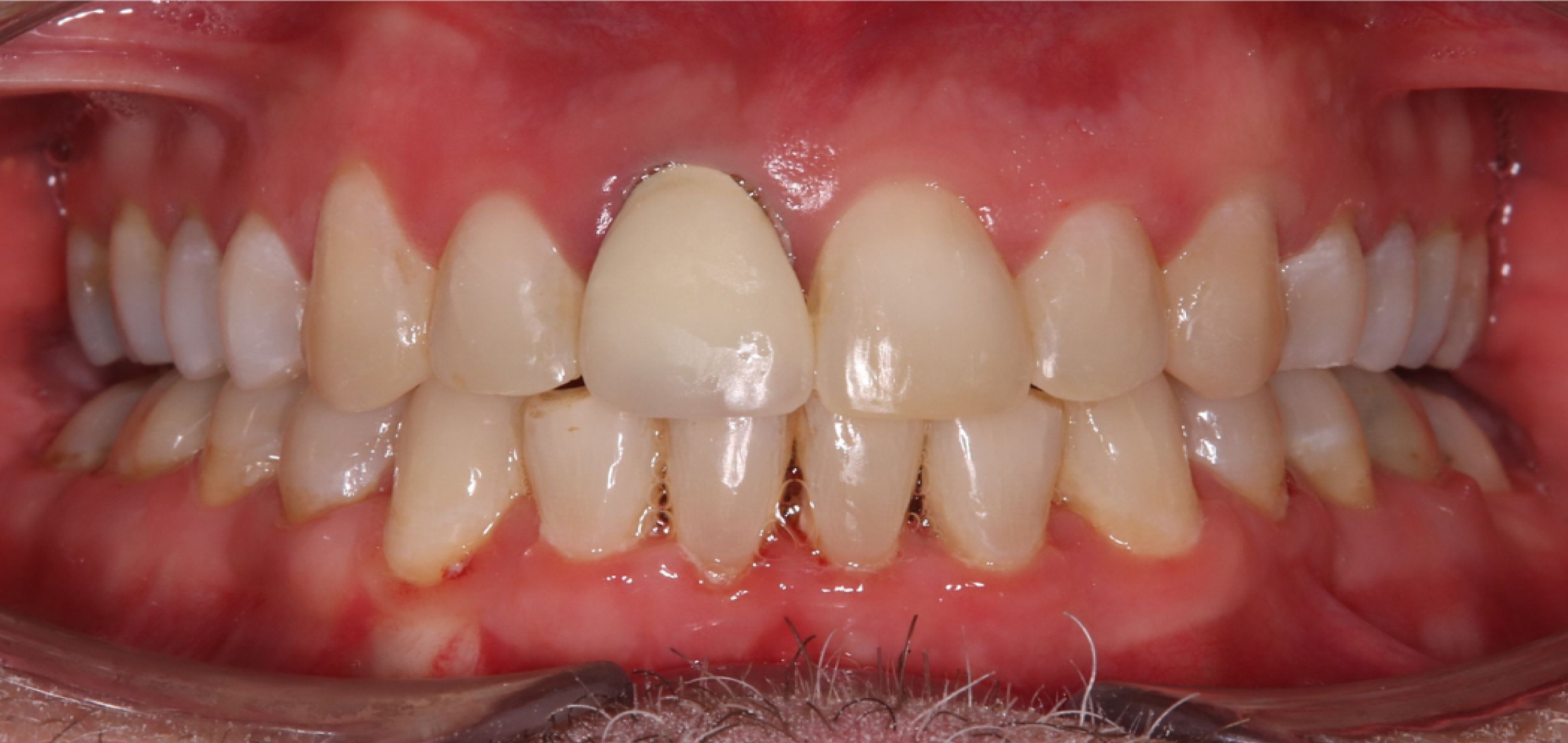 Exemples de cas traités par le Dr Quentin Boison
