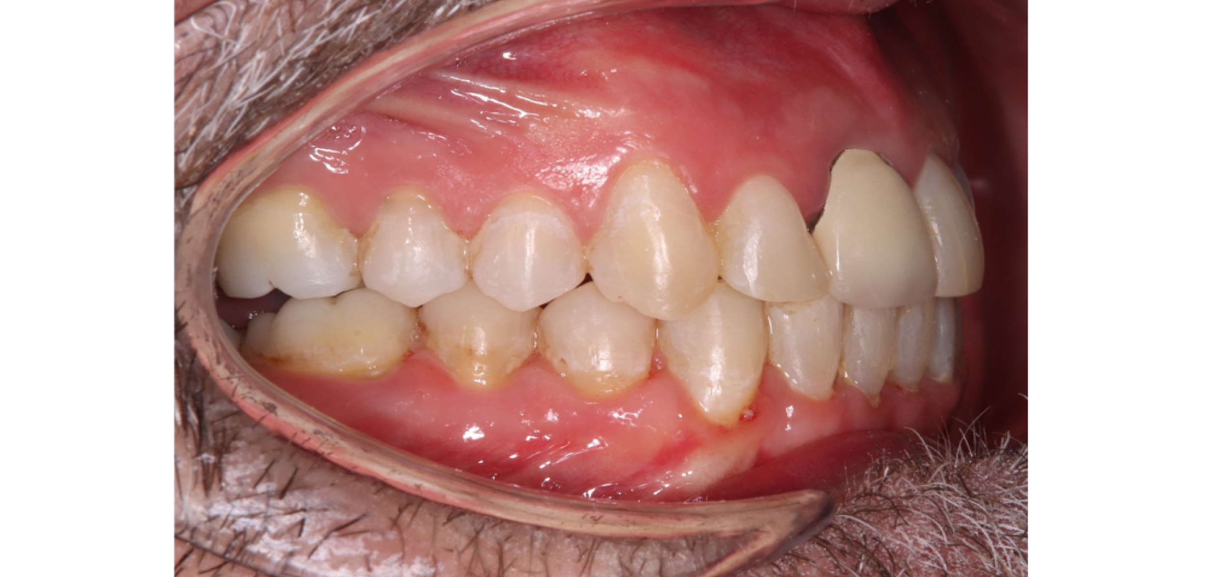 Exemples de cas traités par le Dr Quentin Boison