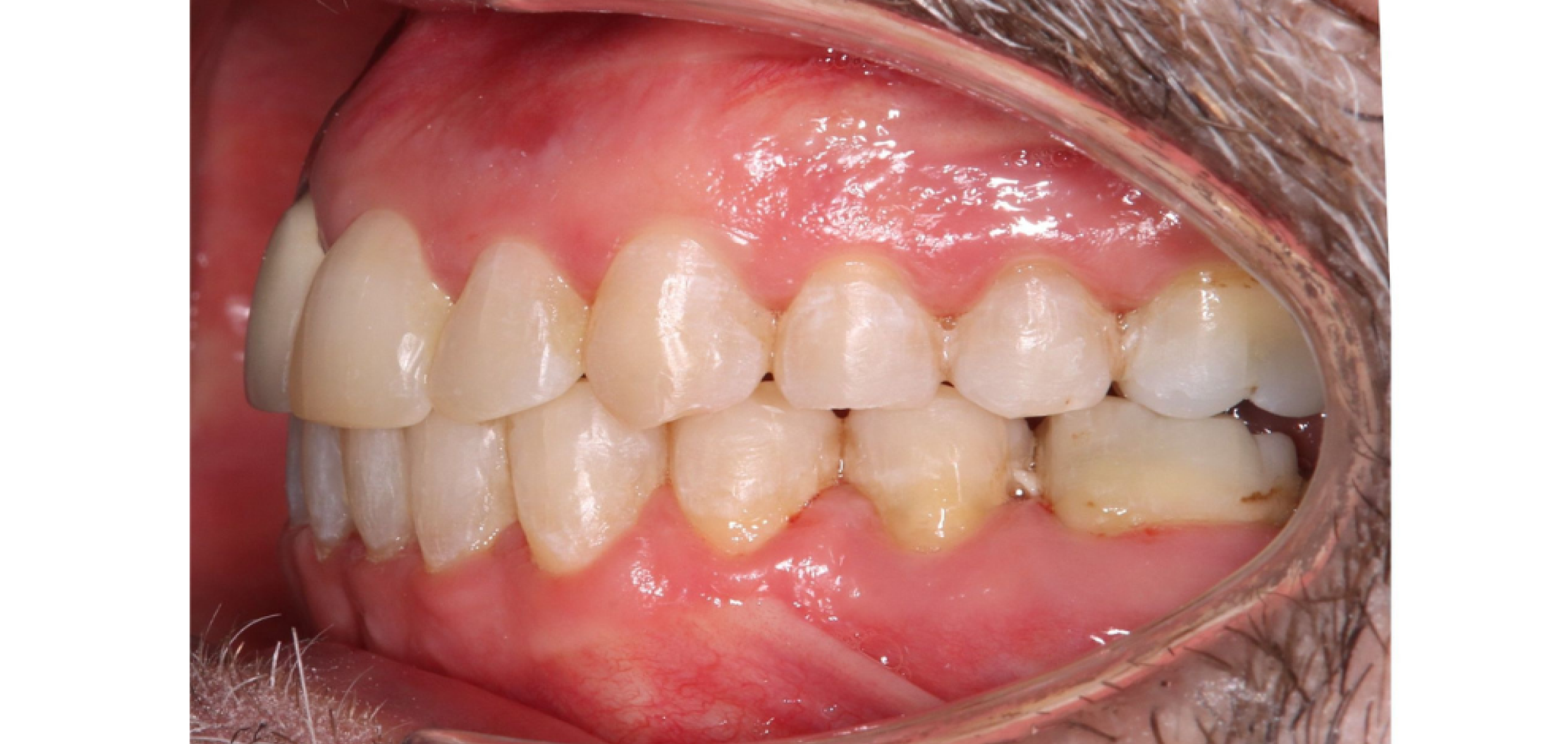 Exemples de cas traités par le Dr Quentin Boison