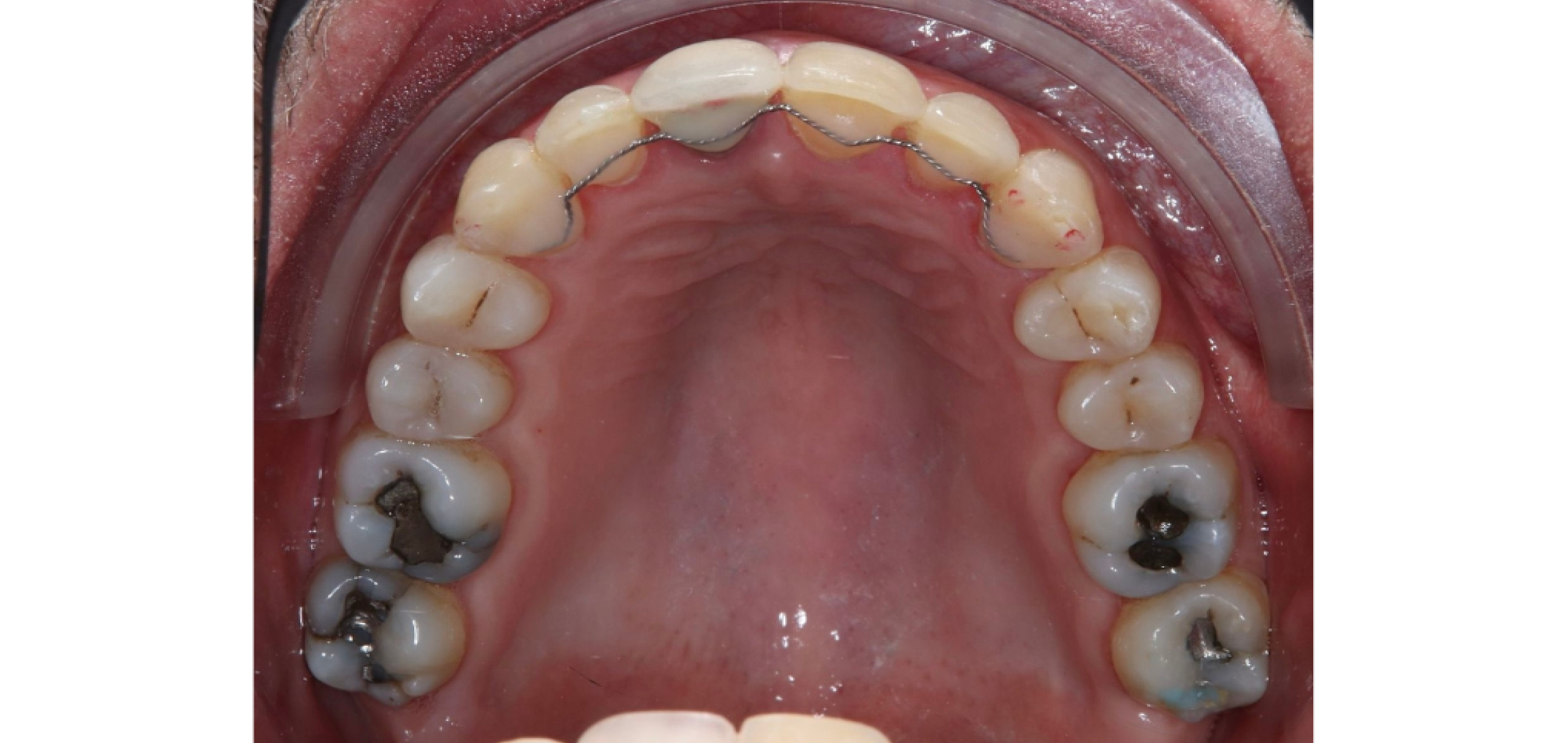 Exemples de cas traités par le Dr Quentin Boison