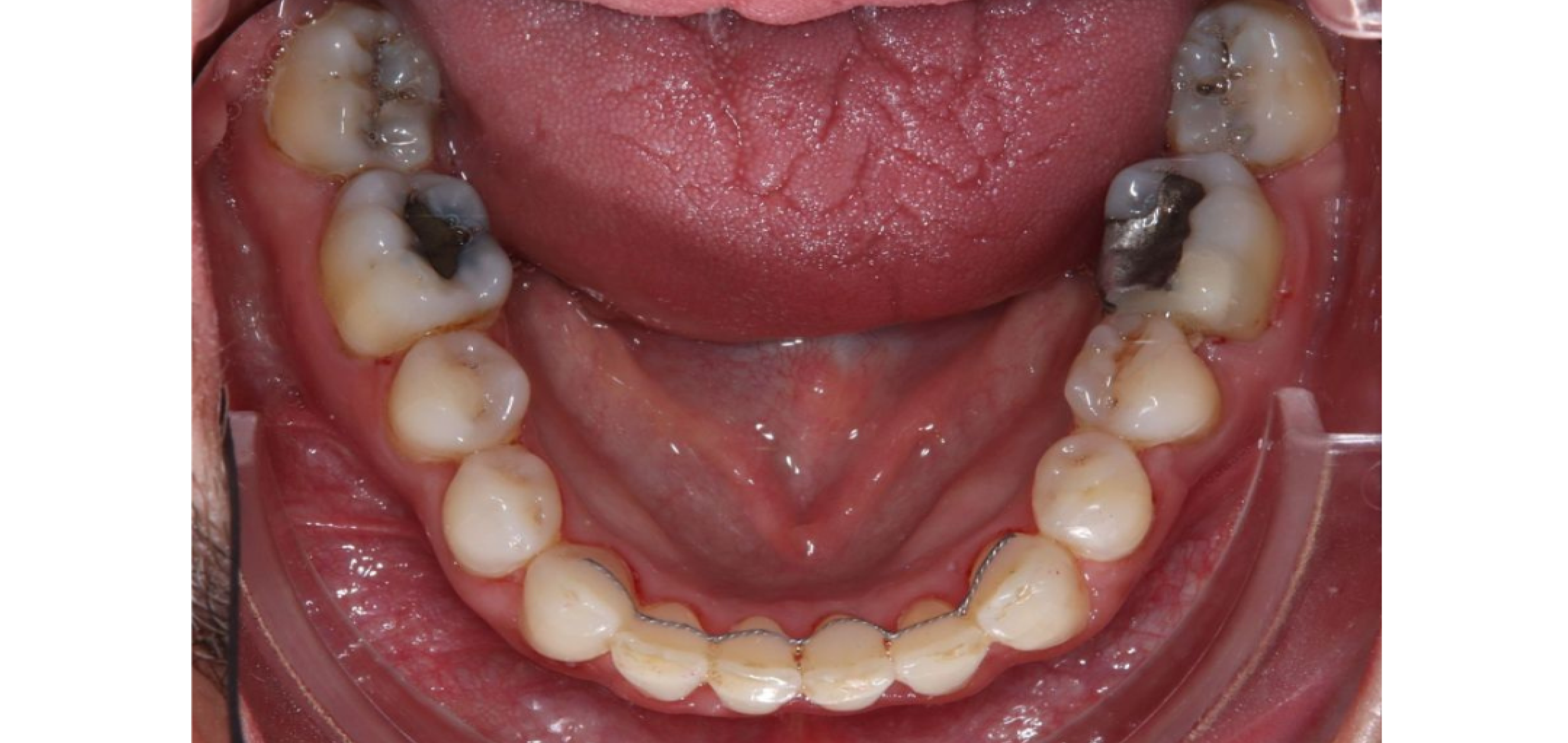 Exemples de cas traités par le Dr Quentin Boison