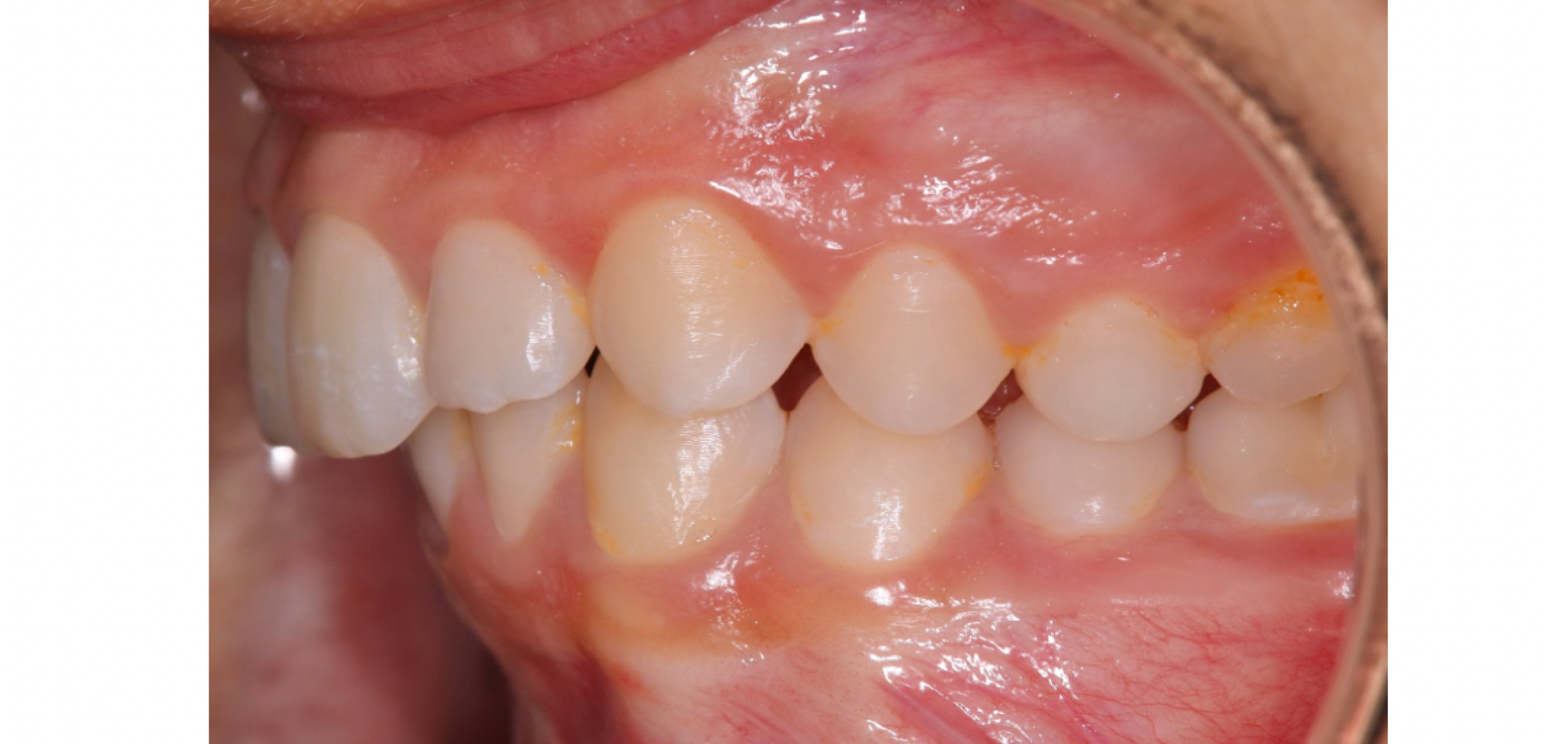 Exemples de cas traités par le Dr Quentin Boison