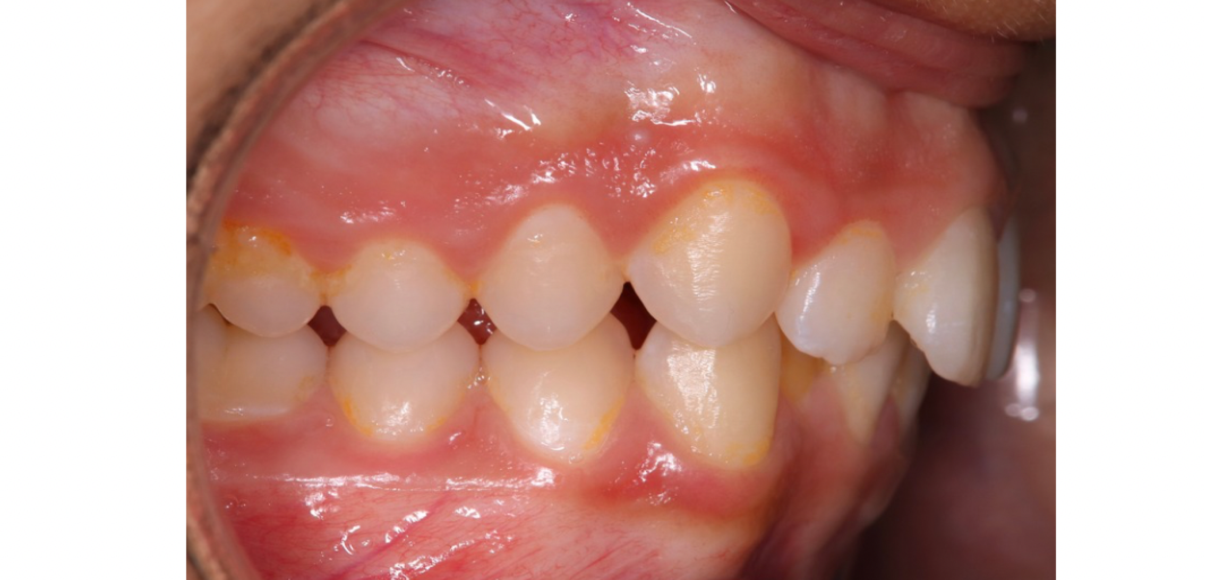 Exemples de cas traités par le Dr Quentin Boison