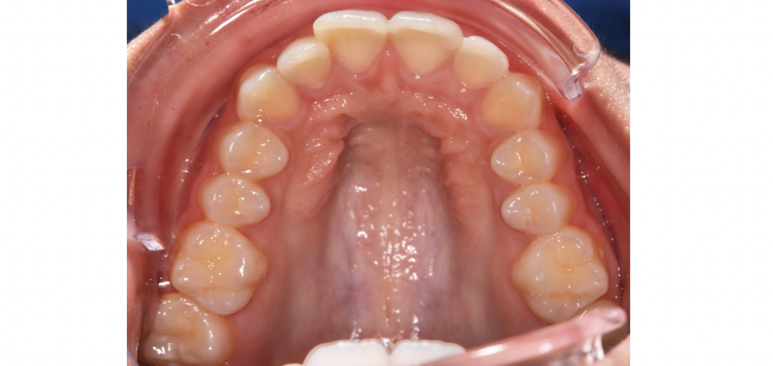 Exemples de cas traités par le Dr Quentin Boison