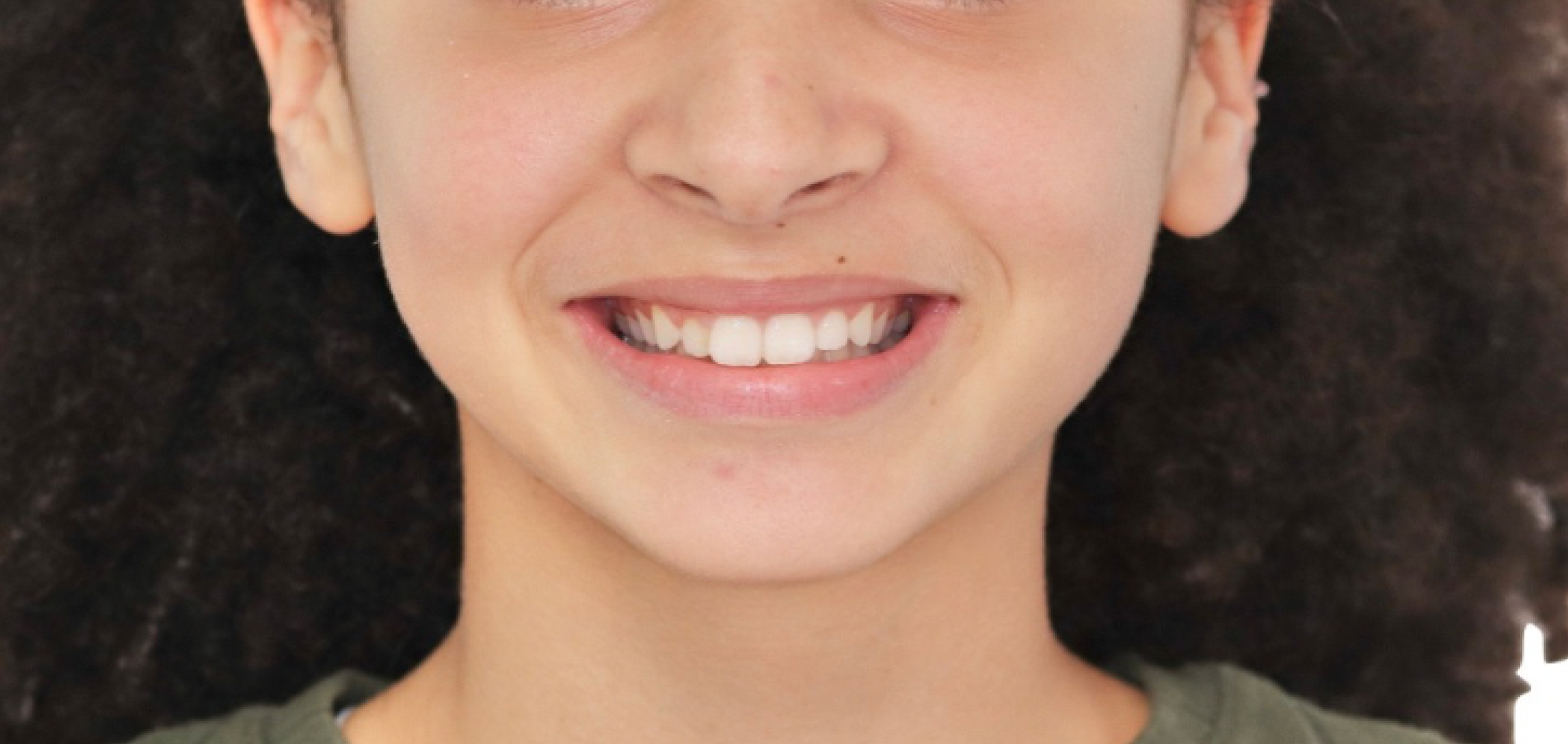 Exemples de cas traités par le Dr Quentin Boison