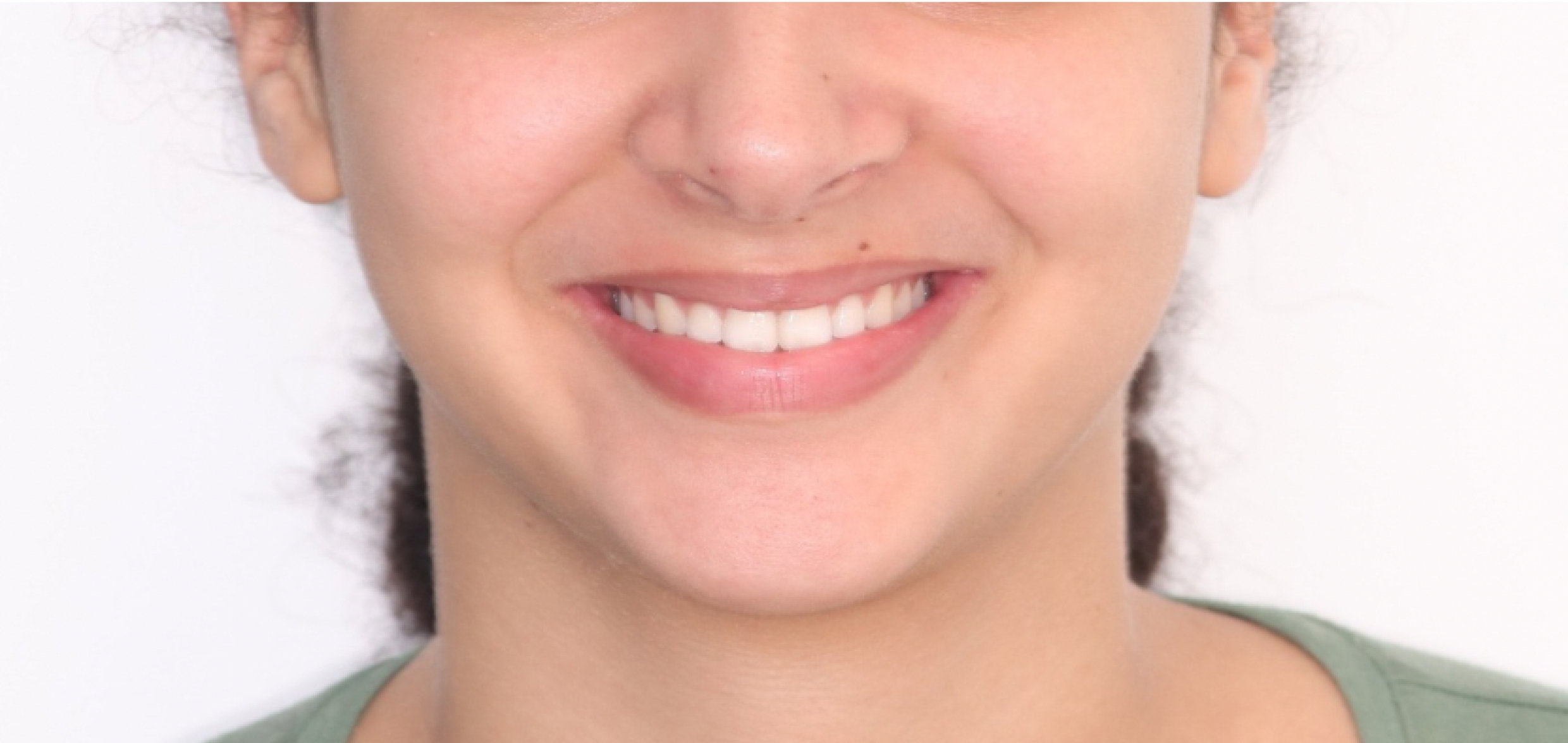 Exemples de cas traités par le Dr Quentin Boison