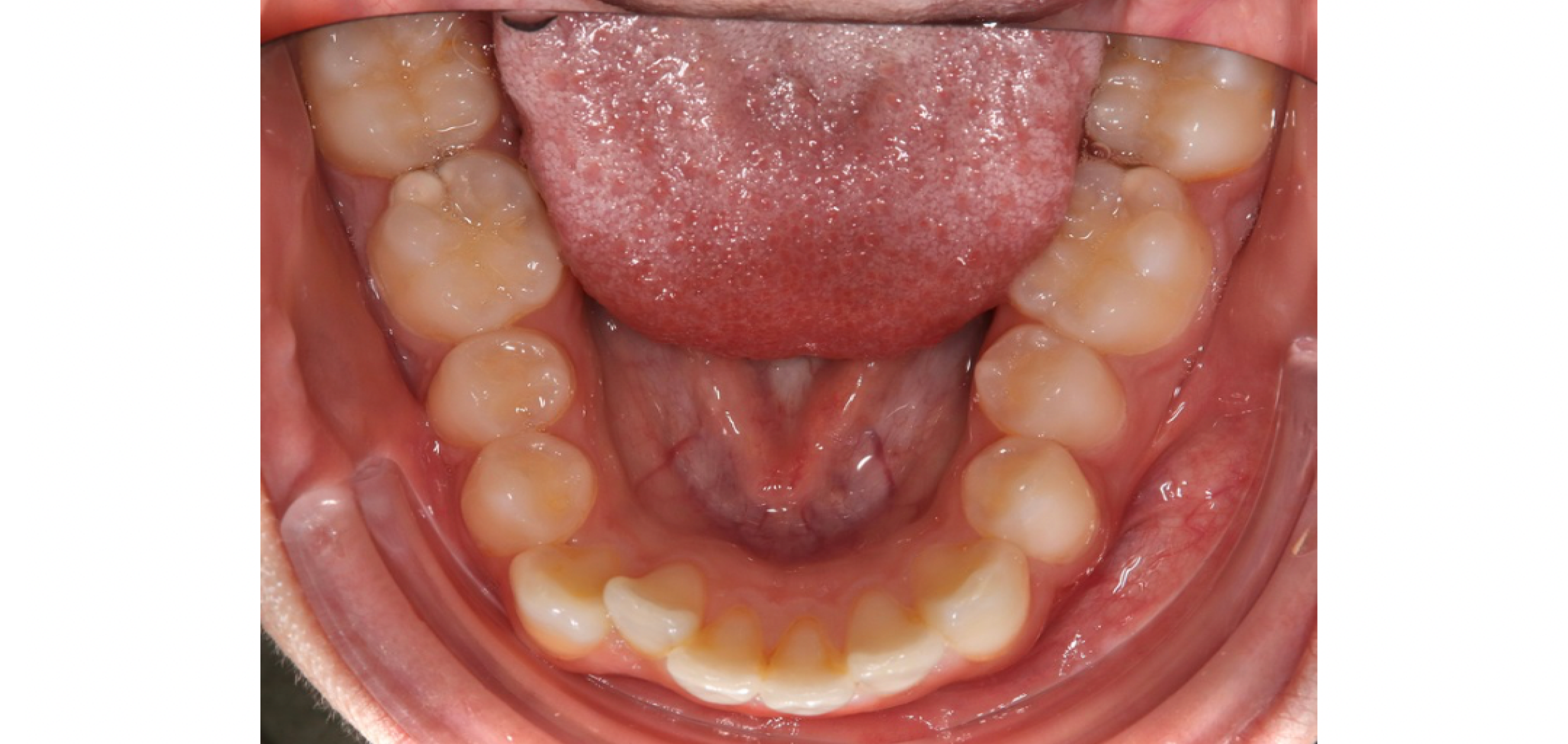 Exemples de cas traités par le Dr Quentin Boison