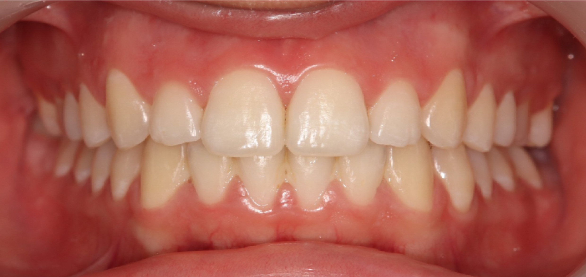 Exemples de cas traités par le Dr Quentin Boison