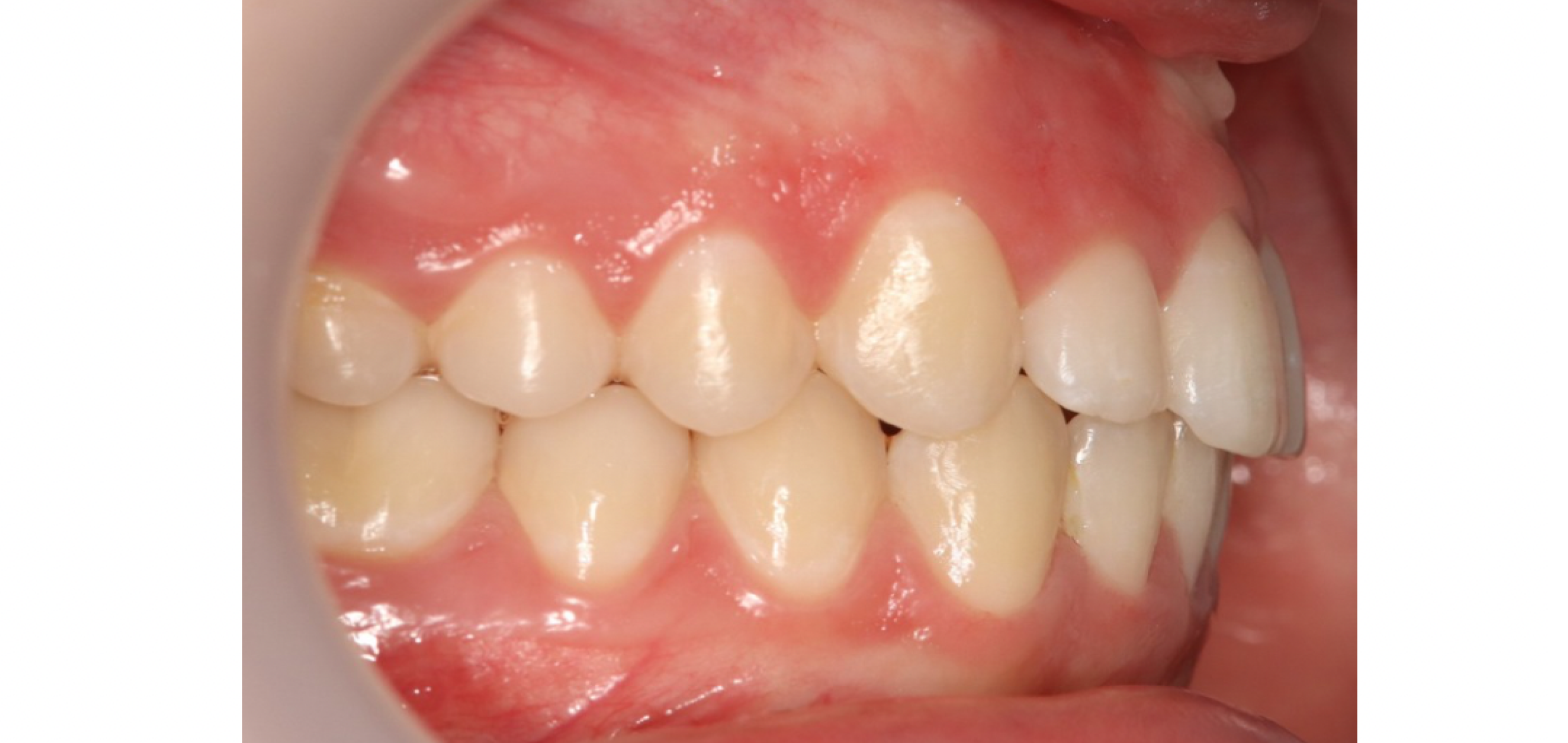 Exemples de cas traités par le Dr Quentin Boison