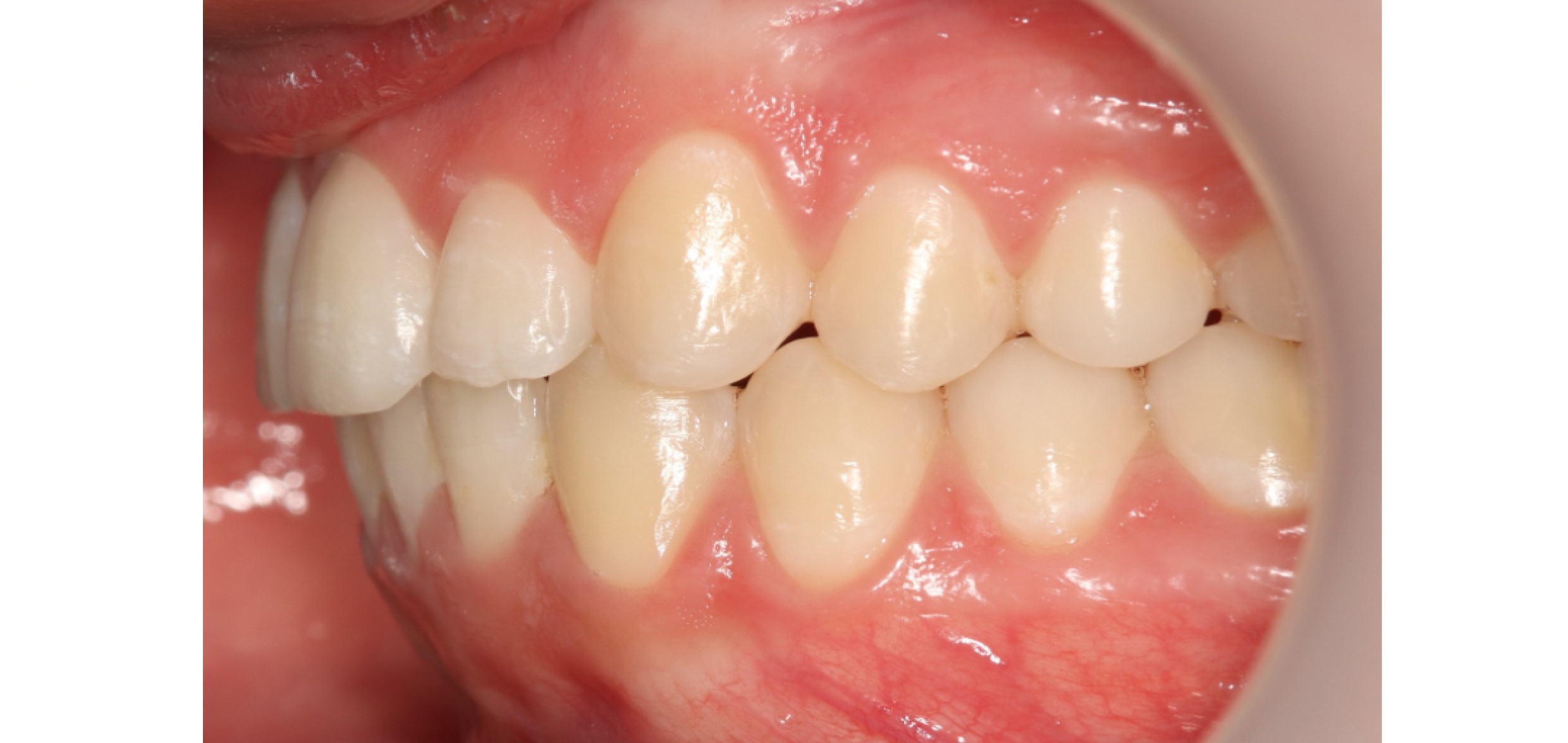 Exemples de cas traités par le Dr Quentin Boison