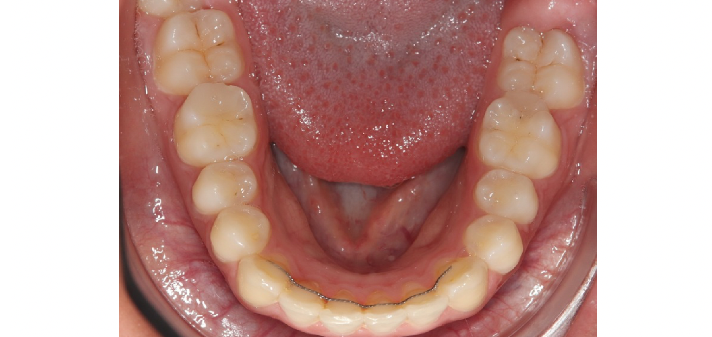 Exemples de cas traités par le Dr Quentin Boison
