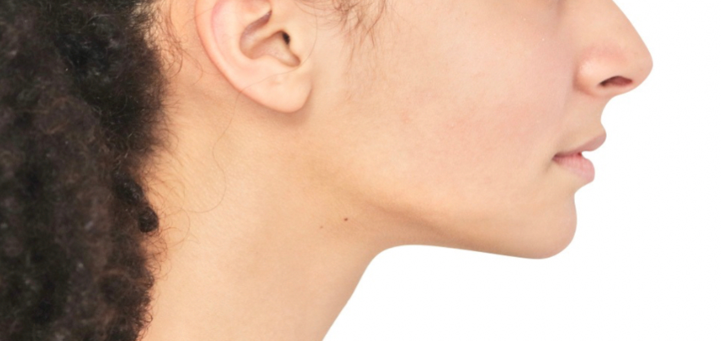 Exemples de cas traités par le Dr Quentin Boison