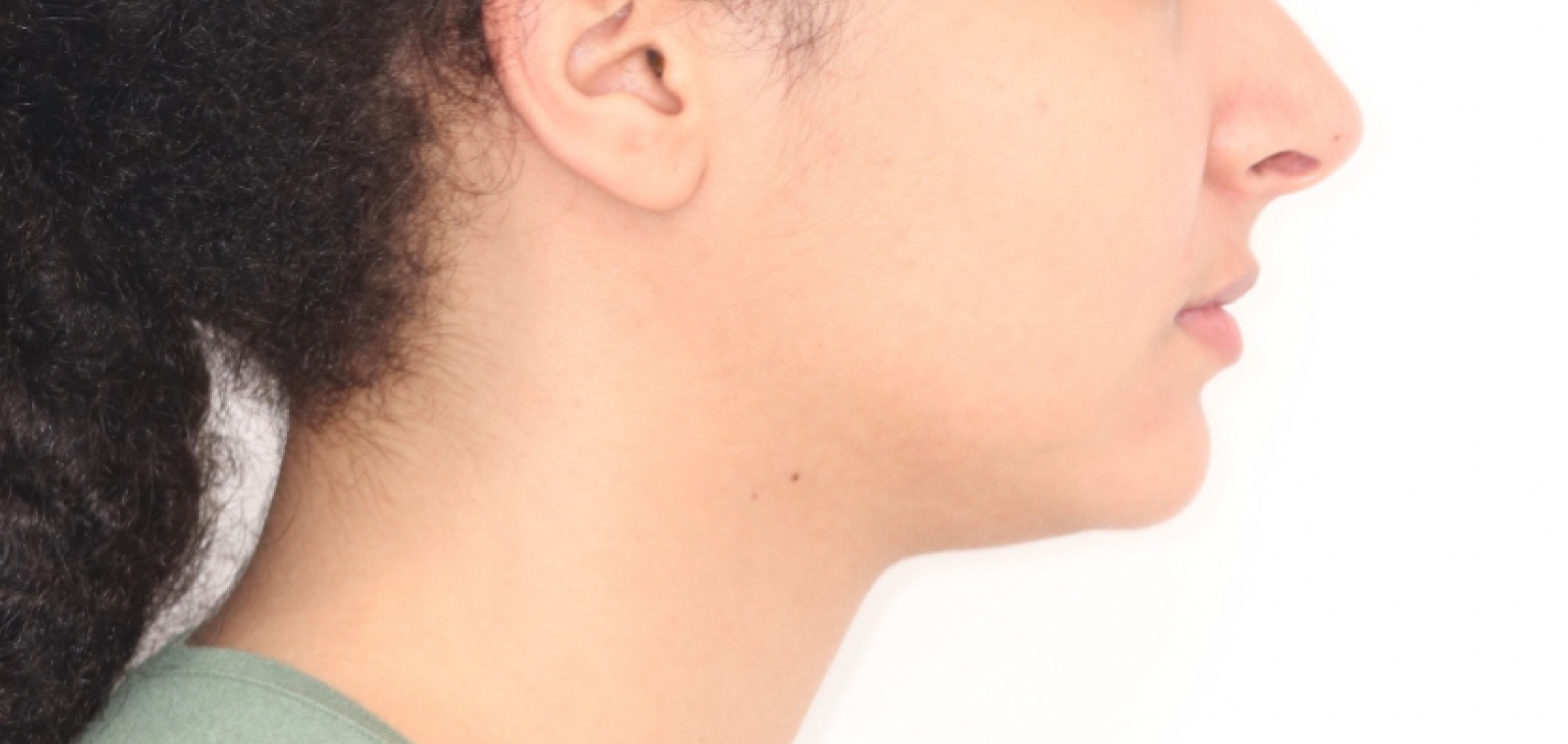 Exemples de cas traités par le Dr Quentin Boison